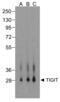 T Cell Immunoreceptor With Ig And ITIM Domains antibody, RF16055, ProSci, Western Blot image 
