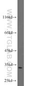 Solute Carrier Family 25 Member 11 antibody, 12253-1-AP, Proteintech Group, Western Blot image 