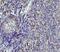 Apolipoprotein B MRNA Editing Enzyme Catalytic Subunit 3G antibody, M00708, Boster Biological Technology, Immunohistochemistry paraffin image 