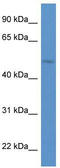 HNF1 Homeobox B antibody, TA334721, Origene, Western Blot image 