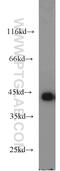 MAGE Family Member B1 antibody, 12400-1-AP, Proteintech Group, Western Blot image 