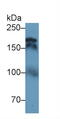 DNA Topoisomerase II Alpha antibody, MBS2027810, MyBioSource, Western Blot image 