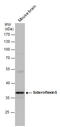 Sideroflexin 5 antibody, GTX120024, GeneTex, Western Blot image 