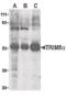 Tripartite Motif Containing 5 antibody, PA5-20051, Invitrogen Antibodies, Western Blot image 