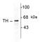 Tyrosine Hydroxylase antibody, AHP931, Bio-Rad (formerly AbD Serotec) , Immunohistochemistry frozen image 