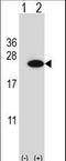 Cold Inducible RNA Binding Protein antibody, LS-C168784, Lifespan Biosciences, Western Blot image 