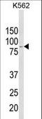 Aldehyde Dehydrogenase 18 Family Member A1 antibody, LS-C156249, Lifespan Biosciences, Western Blot image 