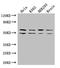 Insulin Like Growth Factor 2 MRNA Binding Protein 3 antibody, orb46808, Biorbyt, Western Blot image 