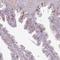 Solute Carrier Family 7 Member 14 antibody, NBP2-13346, Novus Biologicals, Immunohistochemistry frozen image 