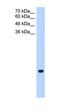 Transmembrane protein 75 antibody, orb325189, Biorbyt, Western Blot image 