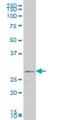 Fibroblast Growth Factor 8 antibody, H00002253-M06, Novus Biologicals, Western Blot image 