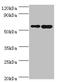 SCP 2 antibody, A54392-100, Epigentek, Western Blot image 