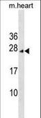 Inhibitor Of CDK, Cyclin A1 Interacting Protein 1 antibody, LS-C159923, Lifespan Biosciences, Western Blot image 