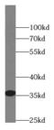 Lymphocyte secreted C-type lectin antibody, FNab01746, FineTest, Western Blot image 
