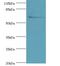 Solute Carrier Family 13 Member 4 antibody, LS-C372283, Lifespan Biosciences, Western Blot image 