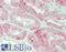SLC22A2 antibody, LS-B13613, Lifespan Biosciences, Immunohistochemistry paraffin image 
