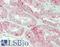 S22A2 antibody, LS-B13613, Lifespan Biosciences, Immunohistochemistry paraffin image 