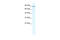 Minichromosome Maintenance Complex Component 4 antibody, 28-542, ProSci, Western Blot image 