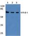 Guanylate Cyclase 1 Soluble Subunit Beta 1 antibody, A32396, Boster Biological Technology, Western Blot image 