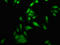 DNA topoisomerase 1 antibody, LS-C672732, Lifespan Biosciences, Immunofluorescence image 