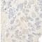 Nucleolar Protein 12 antibody, NBP1-46174, Novus Biologicals, Immunohistochemistry paraffin image 