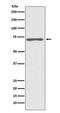 Raf-1 Proto-Oncogene, Serine/Threonine Kinase antibody, M00446, Boster Biological Technology, Western Blot image 