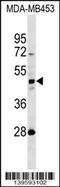 Keratin 31 antibody, 60-162, ProSci, Western Blot image 