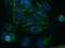 Kelch Like Family Member 2 antibody, 14449-1-AP, Proteintech Group, Immunofluorescence image 