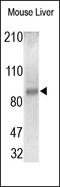 MER Proto-Oncogene, Tyrosine Kinase antibody, 251199, Abbiotec, Western Blot image 