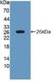 Glycogen phosphorylase, liver form antibody, abx131891, Abbexa, Western Blot image 