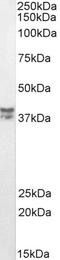 Musashi RNA Binding Protein 2 antibody, STJ73071, St John