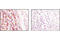 Endoplasmic Reticulum Protein 44 antibody, 3798S, Cell Signaling Technology, Immunohistochemistry paraffin image 