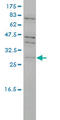 TP53 Regulating Kinase antibody, LS-B4544, Lifespan Biosciences, Western Blot image 