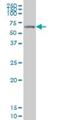 G Protein-Coupled Receptor Kinase 6 antibody, H00002870-M07, Novus Biologicals, Western Blot image 