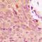 NFKB Inhibitor Alpha antibody, orb338946, Biorbyt, Immunohistochemistry paraffin image 