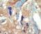 Fms Related Tyrosine Kinase 3 antibody, PA5-14667, Invitrogen Antibodies, Immunohistochemistry paraffin image 