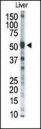 Matrix Metallopeptidase 8 antibody, PA5-13198, Invitrogen Antibodies, Western Blot image 