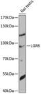 Leucine Rich Repeat Containing G Protein-Coupled Receptor 6 antibody, 15-409, ProSci, Western Blot image 