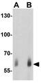 Malic Enzyme 2 antibody, GTX31915, GeneTex, Western Blot image 