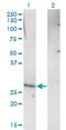 Rhox Homeobox Family Member 1 antibody, MA5-23128, Invitrogen Antibodies, Western Blot image 