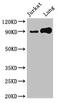 Signal Transducer And Activator Of Transcription 5B antibody, CSB-PA022815LA01HU, Cusabio, Western Blot image 