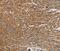 Poly(ADP-Ribose) Polymerase Family Member 11 antibody, PA5-50474, Invitrogen Antibodies, Immunohistochemistry paraffin image 
