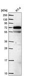 Endonuclease/Exonuclease/Phosphatase Family Domain Containing 1 antibody, PA5-65812, Invitrogen Antibodies, Western Blot image 