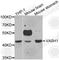 Vasohibin 1 antibody, A6148, ABclonal Technology, Western Blot image 