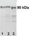 Insulin Like Growth Factor 1 Receptor antibody, AHO1292, Invitrogen Antibodies, Western Blot image 