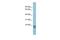 Surfactant Protein C antibody, GTX47152, GeneTex, Western Blot image 