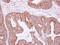 Interleukin 1 Alpha antibody, NBP2-16939, Novus Biologicals, Immunohistochemistry paraffin image 