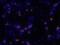 CD40 Molecule antibody, AF440, R&D Systems, Immunocytochemistry image 