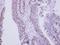 Zinc Finger Protein 329 antibody, GTX122136, GeneTex, Immunohistochemistry paraffin image 