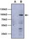 Aryl Hydrocarbon Receptor antibody, NB300-515, Novus Biologicals, Western Blot image 